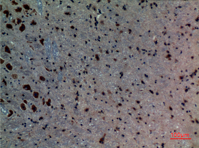 IHC - ALK-1 Polyclonal Antibody AP73365
